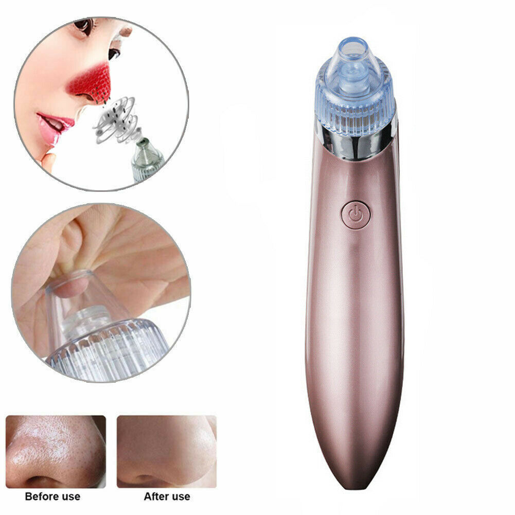 Electric Blackhead Vacuum