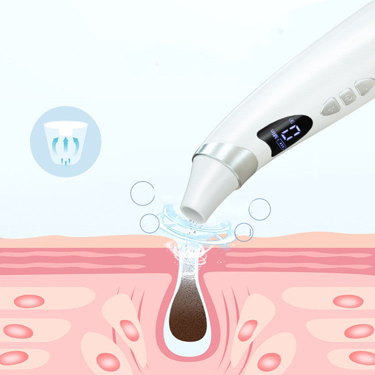 Electric Visual Blackhead Suction Tool