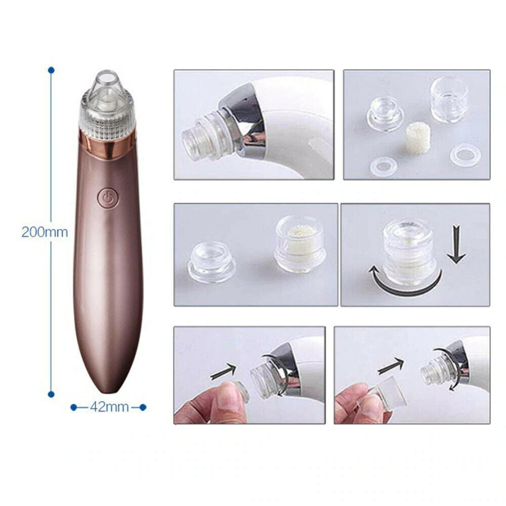 Electric Blackhead Vacuum