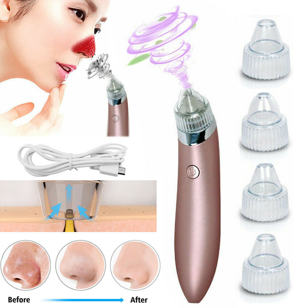Electric Blackhead Vacuum