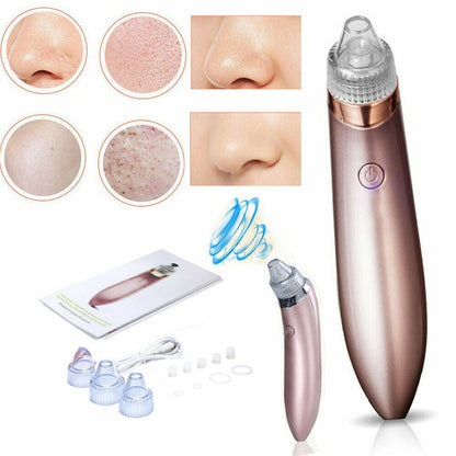 Electric Blackhead Vacuum